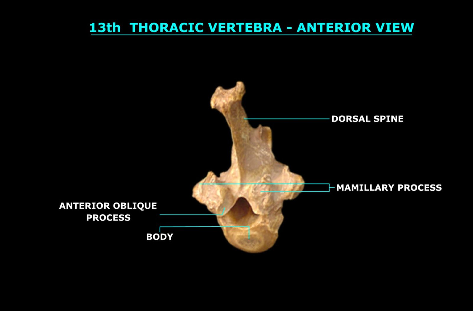 13th THORACIC VERTEBRA (ANTERIOR VIEW)