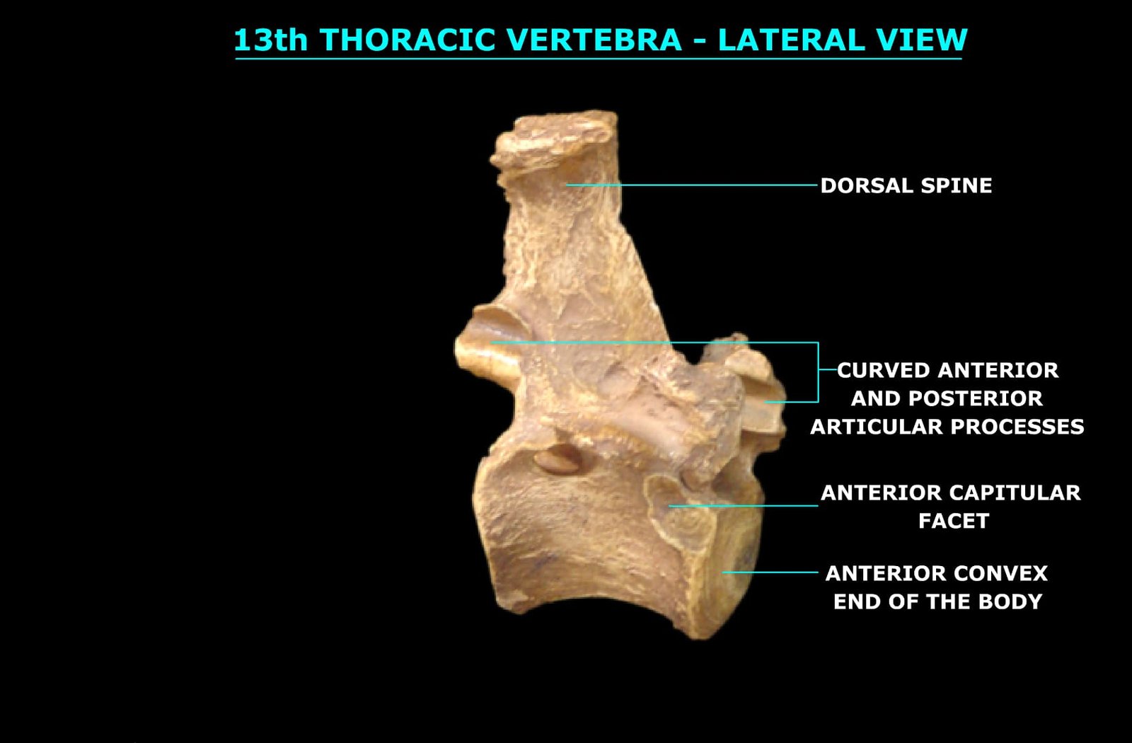 13th THORACIC VERTEBRA (LATERAL VIEW)