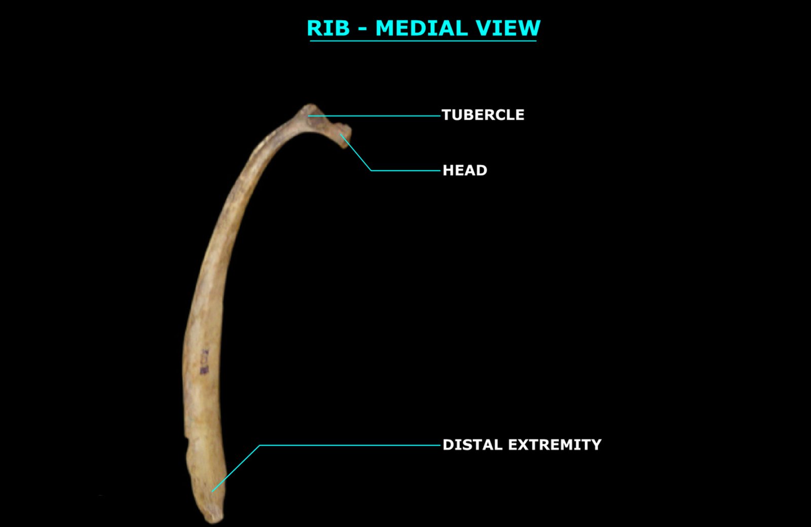 RIB (MEDIAL VIEW)