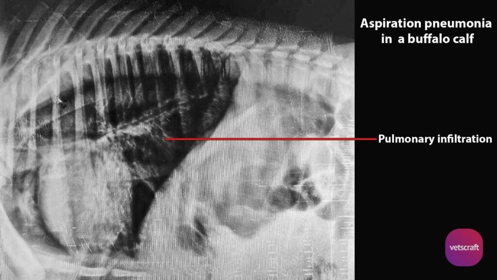 Radiographic features of specific conditions- Aspiration pneumonia in a buffalo calf