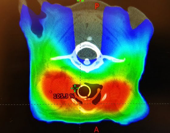 Principles of radiation therapy and Isotopes in veterinary practices - vetscraft