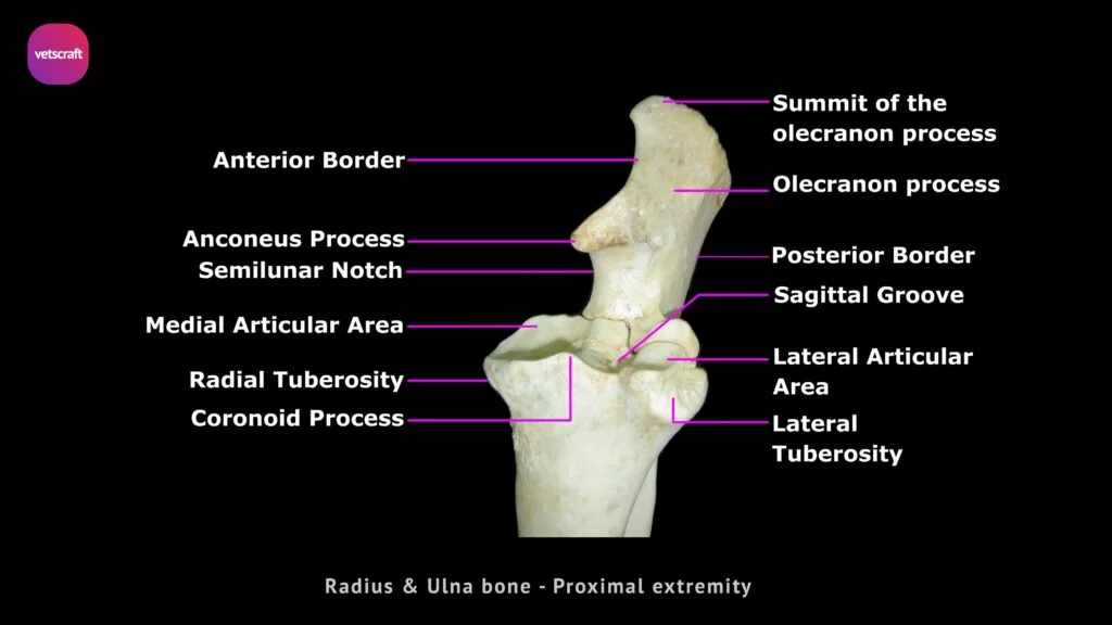 Radius & Ulna bone- Proximal extremity