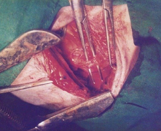 Thoracotomy in animals