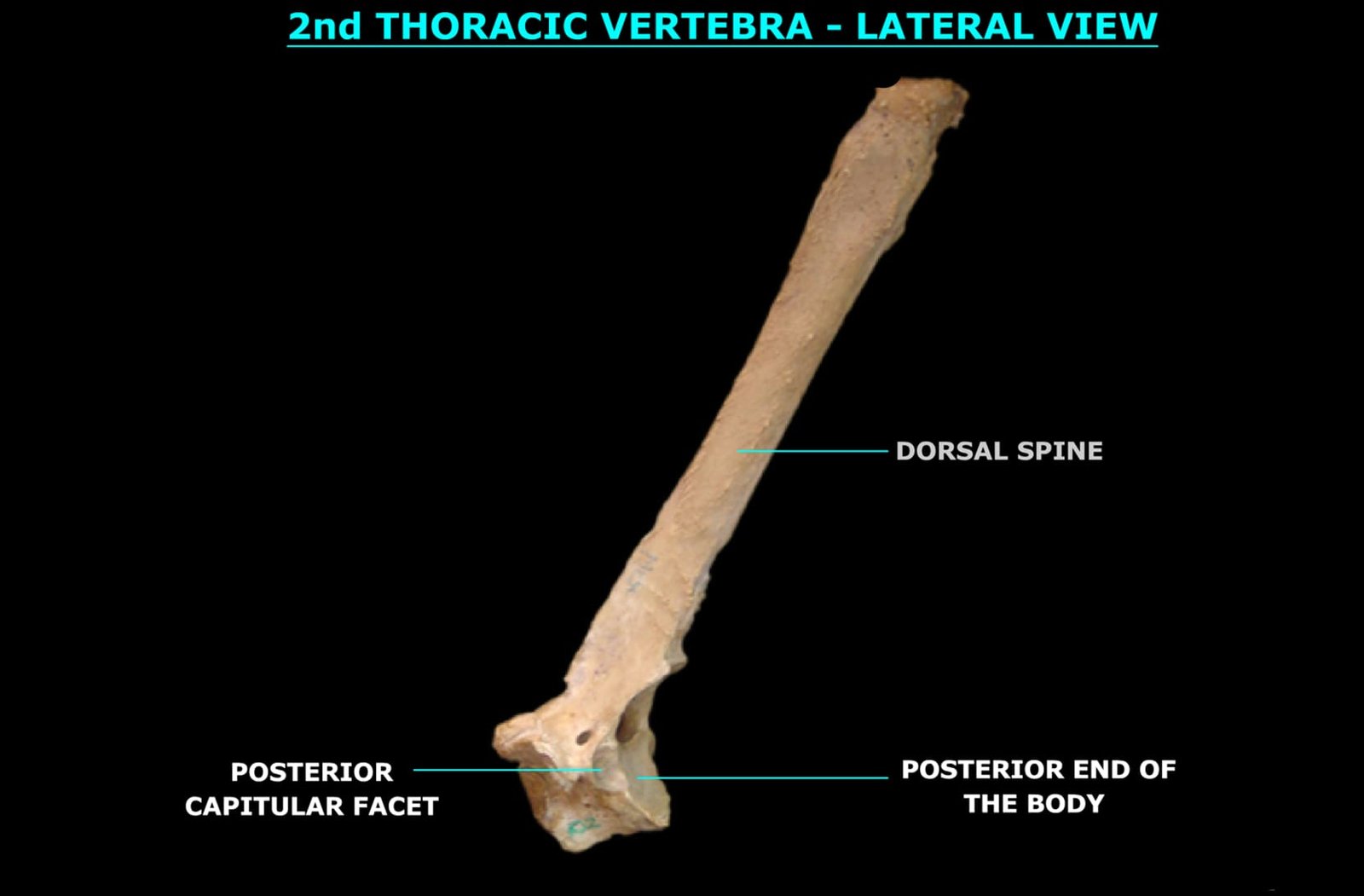 2nd THORACIC VERTEBRA (LATERAL VIEW)