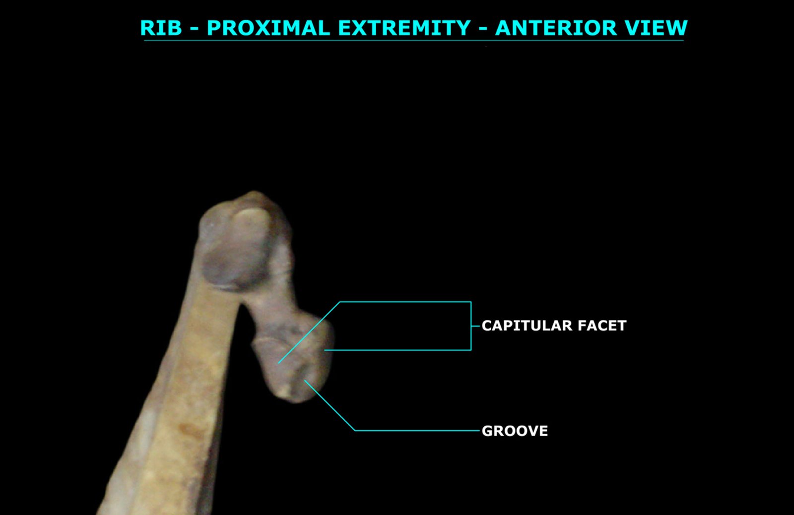 RIB (PROXIMAL EXTREMITY) (ANTERIOR VIEW)