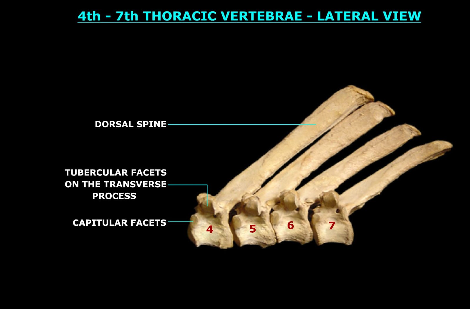 4th to 7th THORACIC VERTEBRAE (LATERAL VIEW)