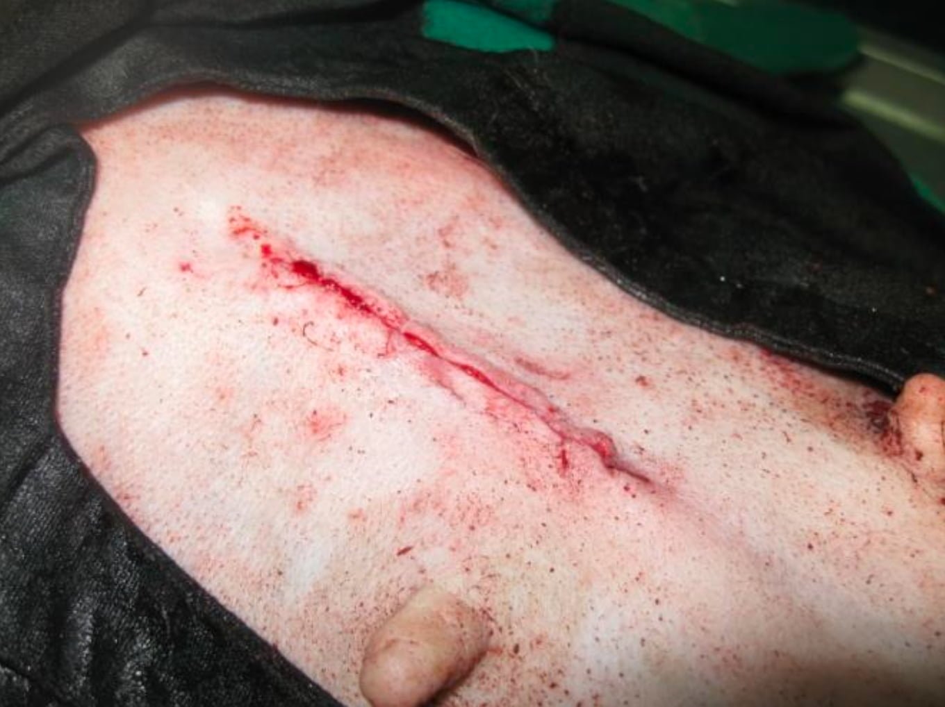 After Suturing