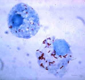 Causative agent of Canine Eperythrozoan Infection