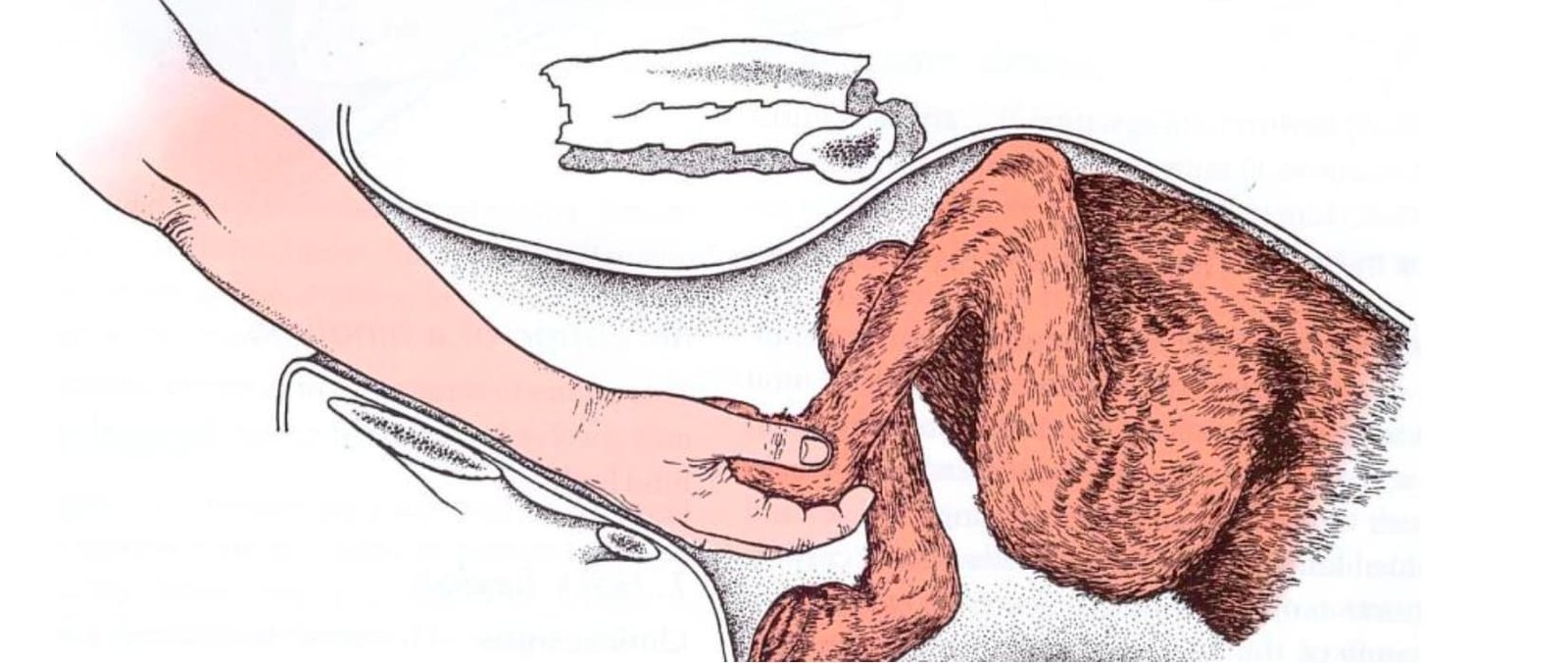 Correction of Hock Flexion