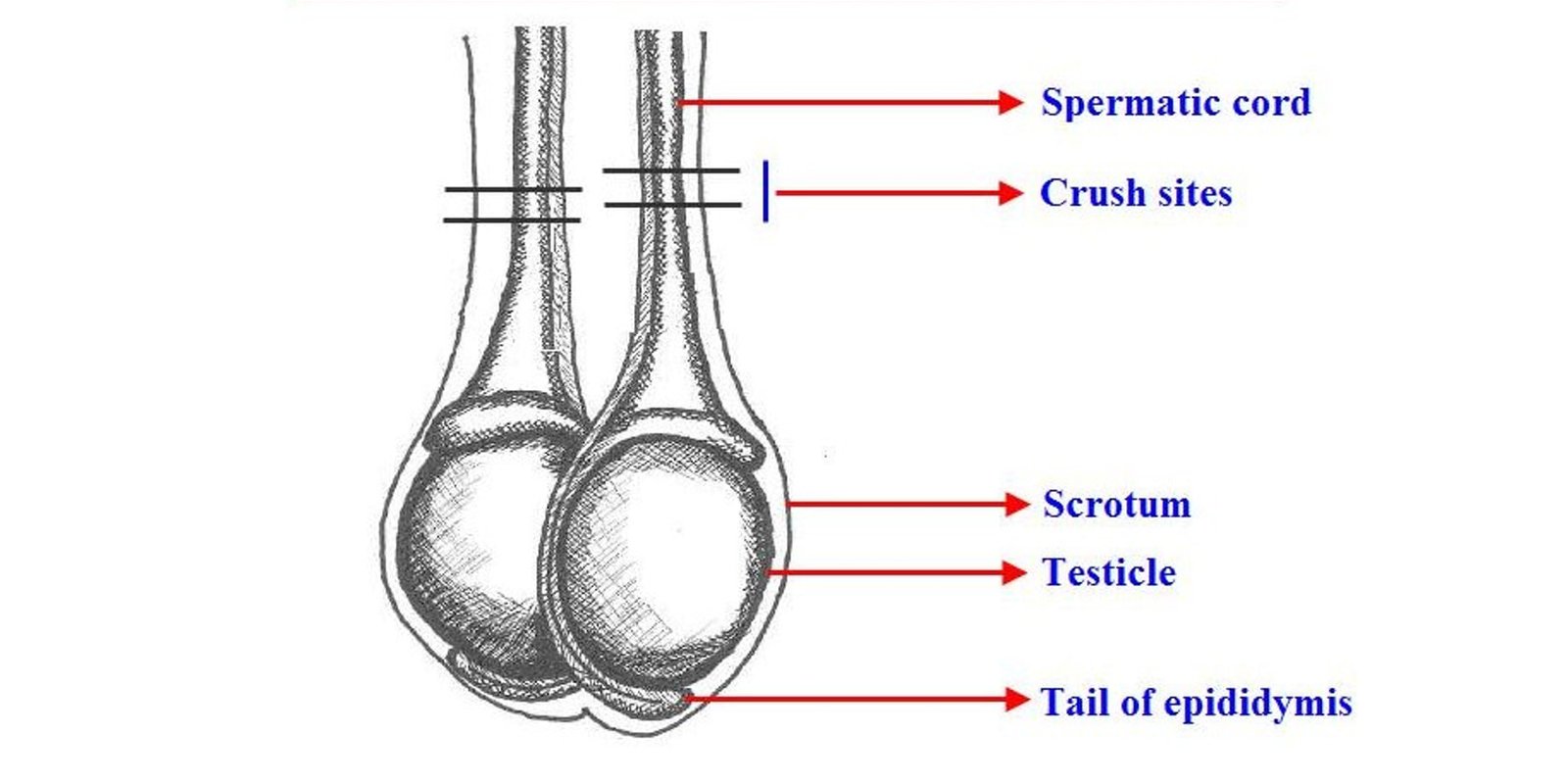 Crush Sites (Castration Using Burdizzo Castrator)