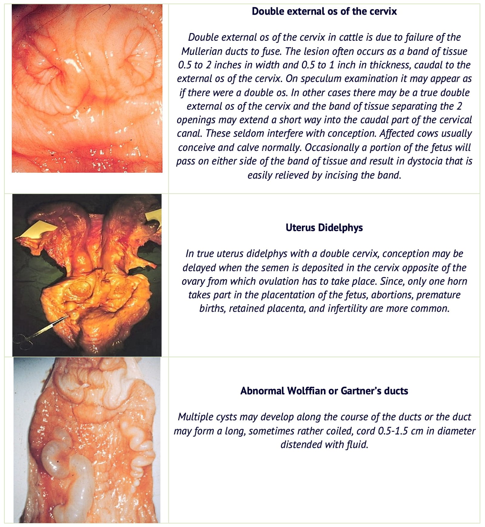 Double External Os of the Cervix, Uterus Didelphys and Abnormal Wolffian or Gartner’s Ducts