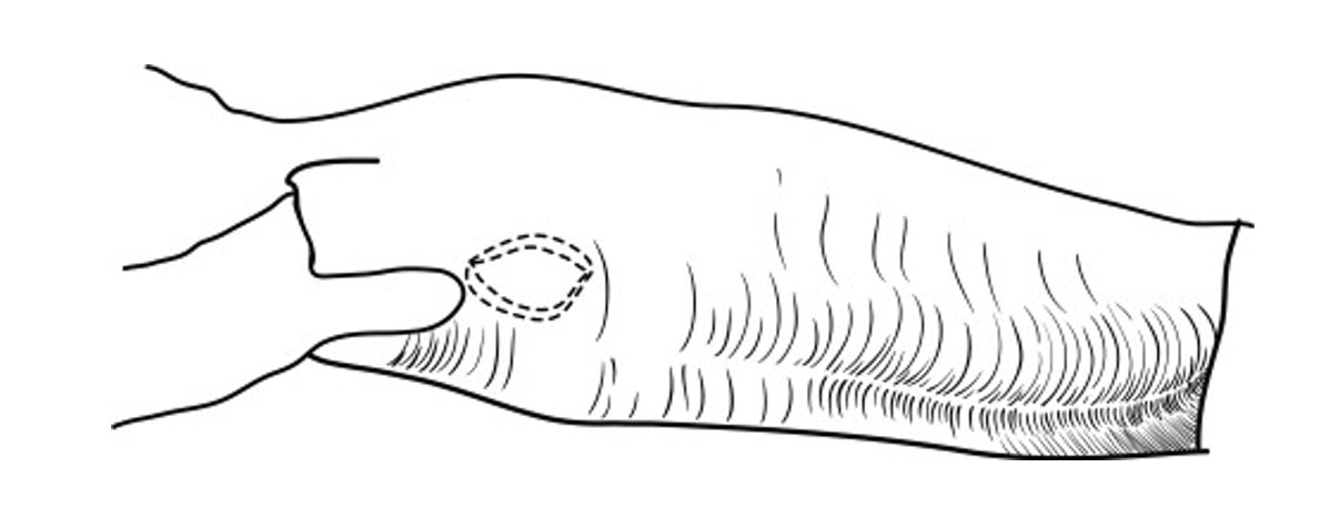 Elliptical incision (1-cm-diameter) is made through the skin 7 cm caudal to the preputial orifice
