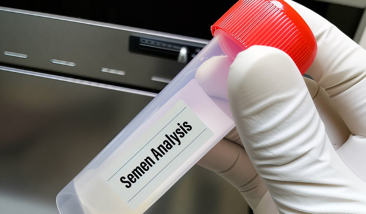 Fructolytic Index in Semen Analysis