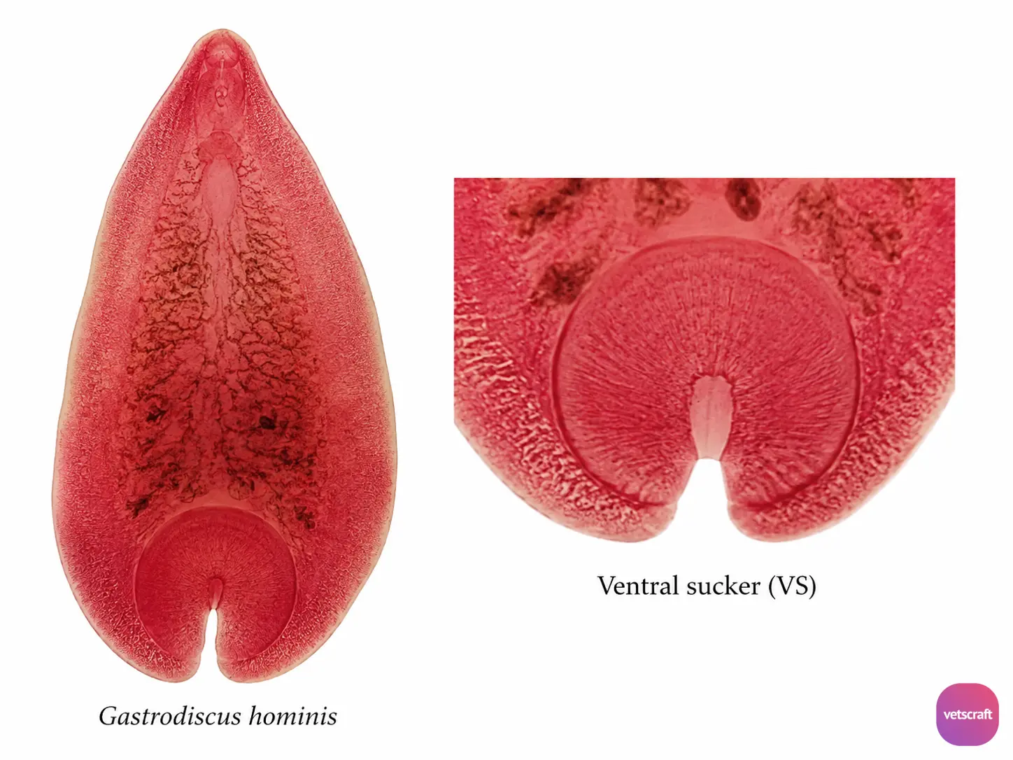 Gastrodiscus hominis (Intestinal Amphistome of Humans and Pigs)