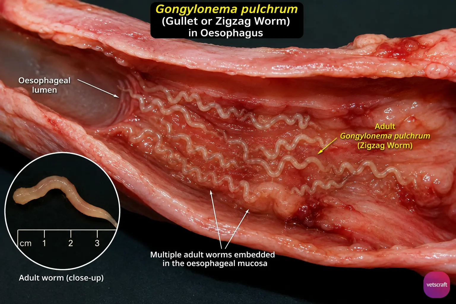 Gongylonema pulchrum (Gullet or Zigzag Worm) Infection