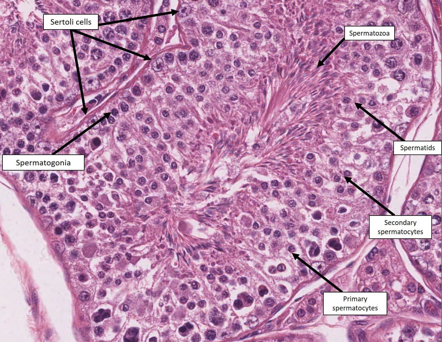 Spermatid Histology Spermatid An Overview ScienceDirect Topics