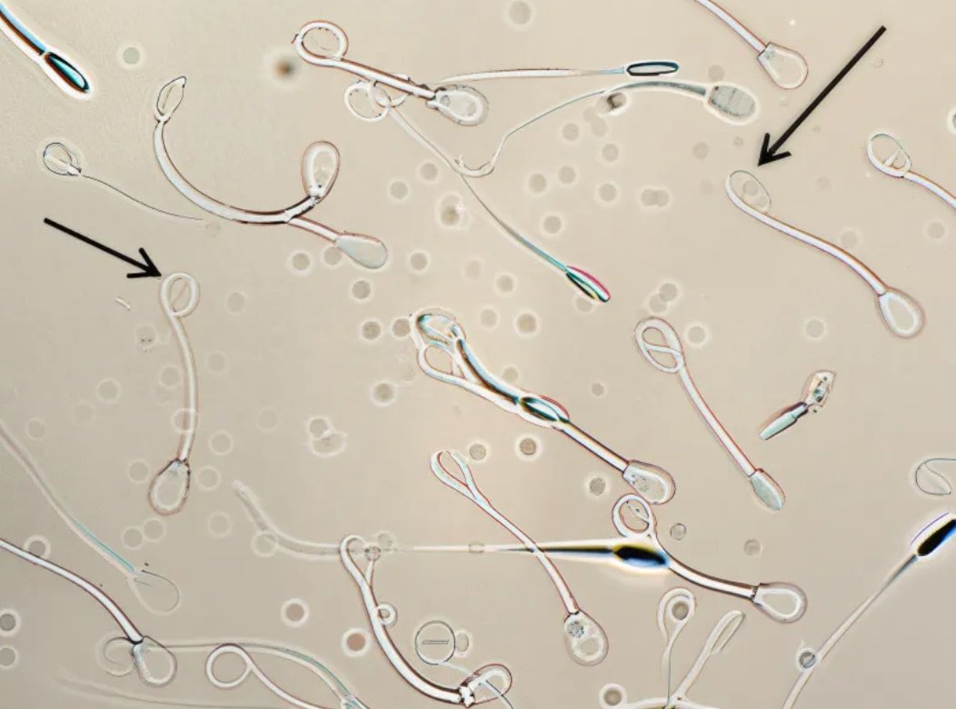 Hypo Osmotic Swelling Test (HOST) Practical Examination