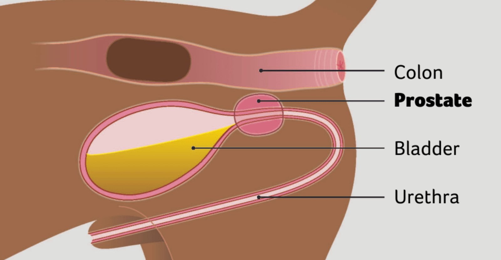 Illustration of Canine Prostatitis: Inflammation and Enlargement of the Prostate Gland
