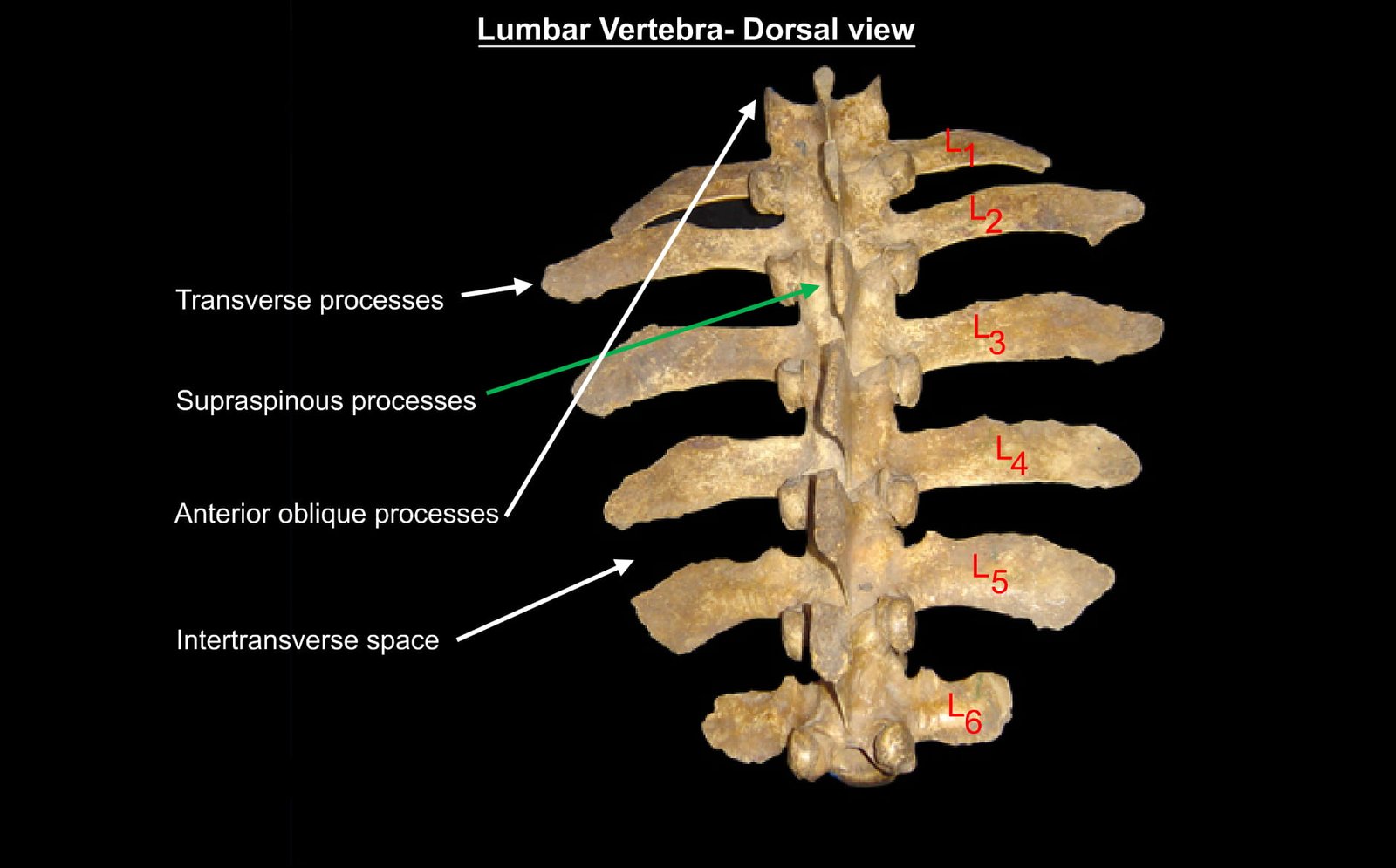 Lumbar Vertebrae (Dorsal View)