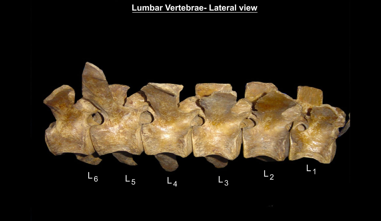 Lumbar Vertebrae (Lateral View)