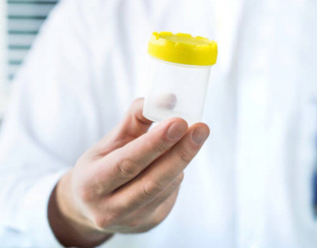 Macroscopic Examination of Semen