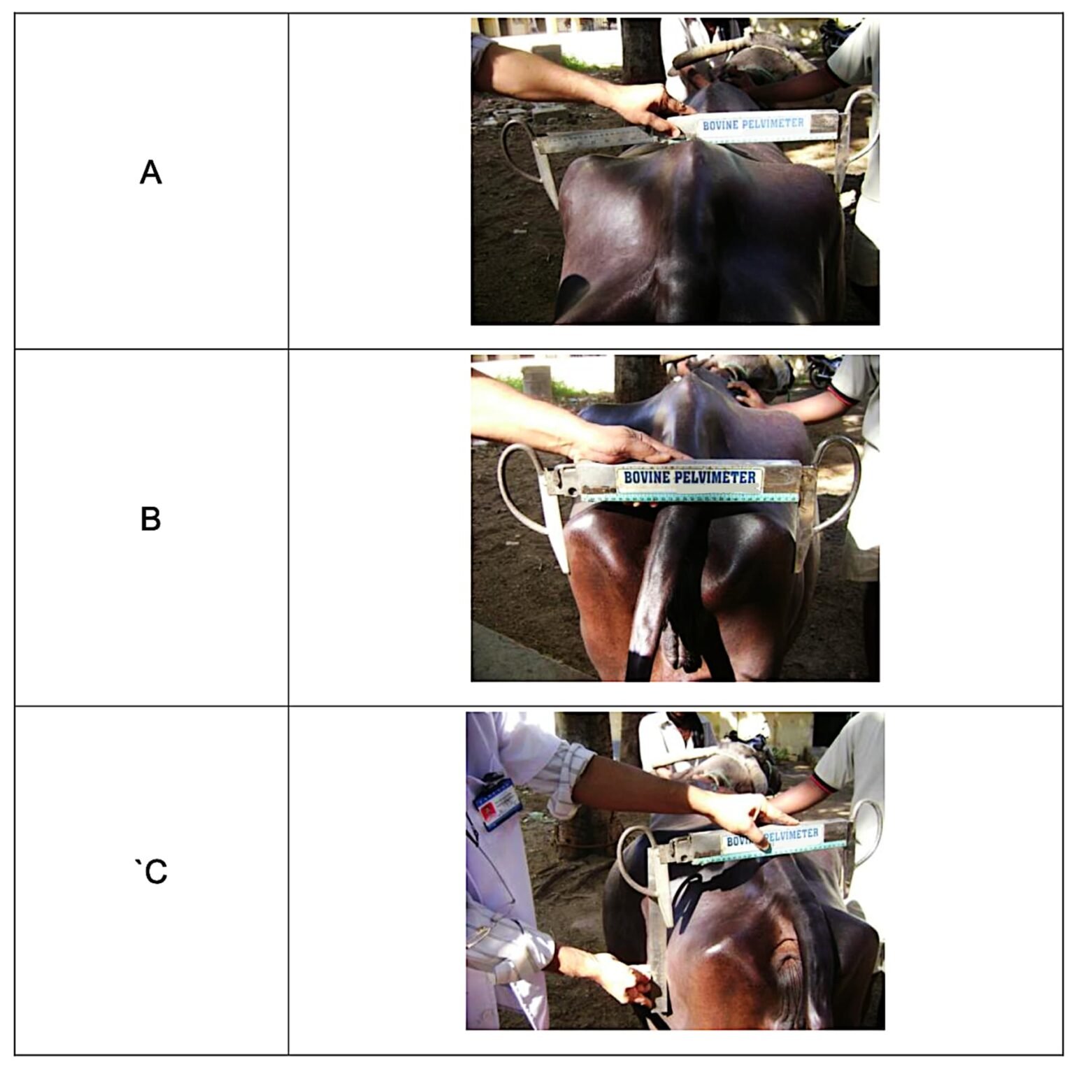 Pelvimetry | Biometry of the Pelvis