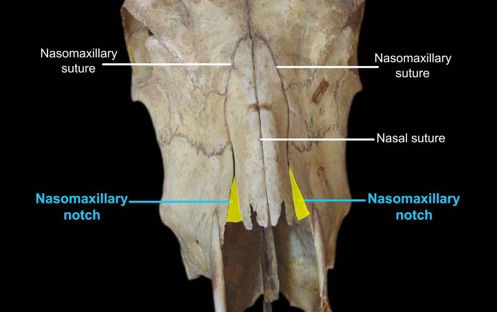 Nasomaxillary Notch and Sutures of the Nasal Bone in Ox
