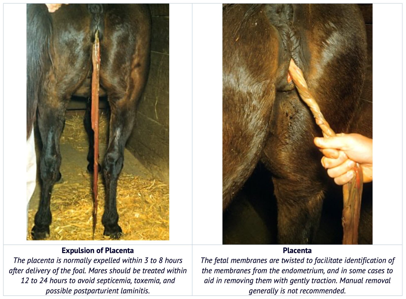 Normal and Manual Expulsion of Placenta