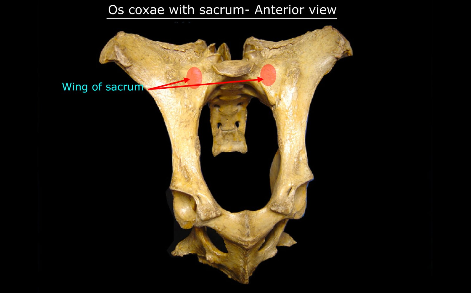 Os Coxae with Sacrum (Anterior View) in Ox (1)