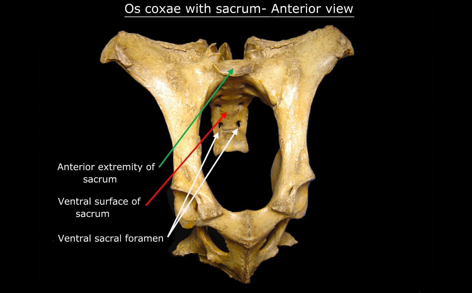 Os Coxae with Sacrum (Anterior View) in Ox (2)