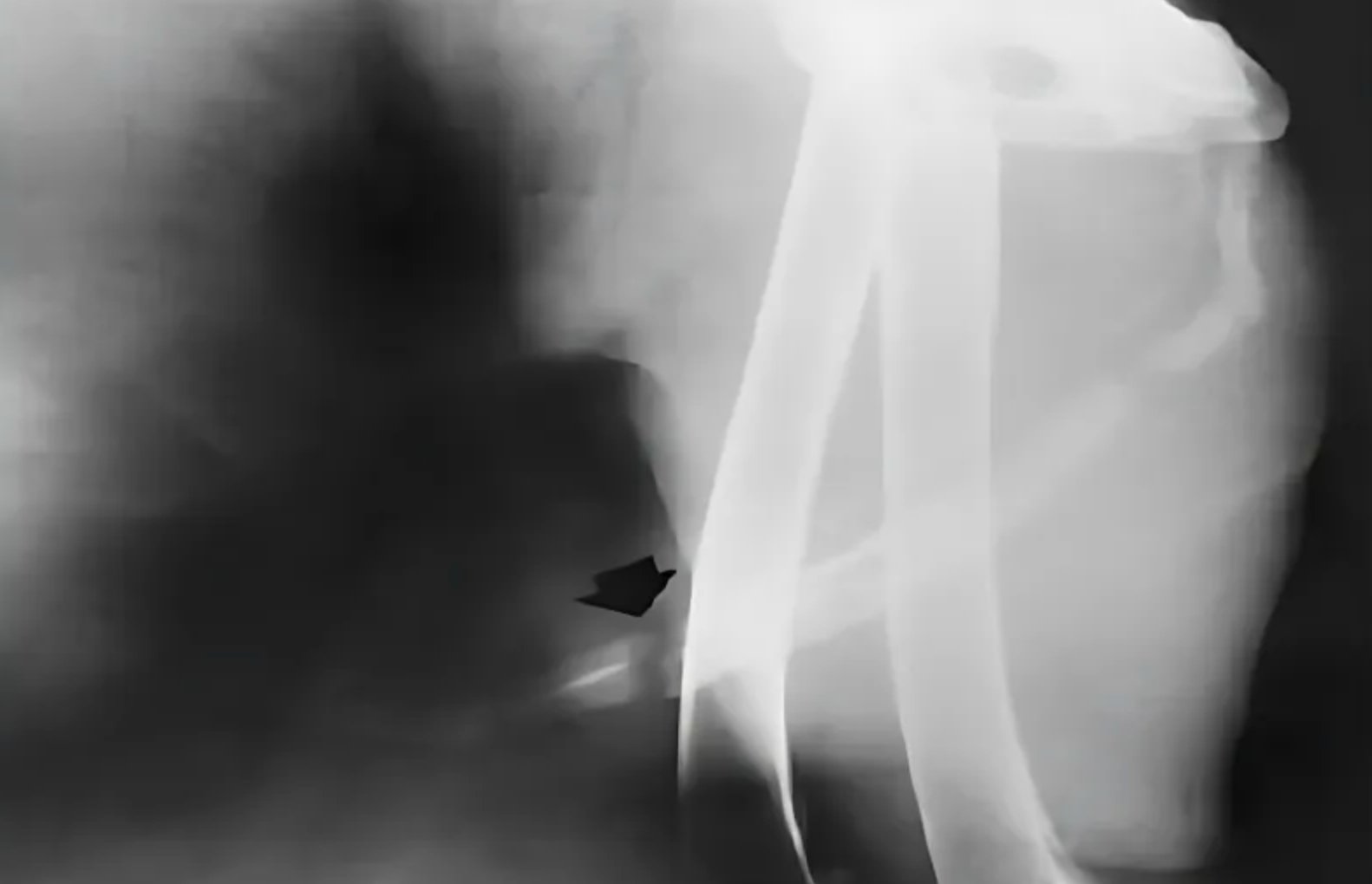 Os Penis Fracture in a Dog