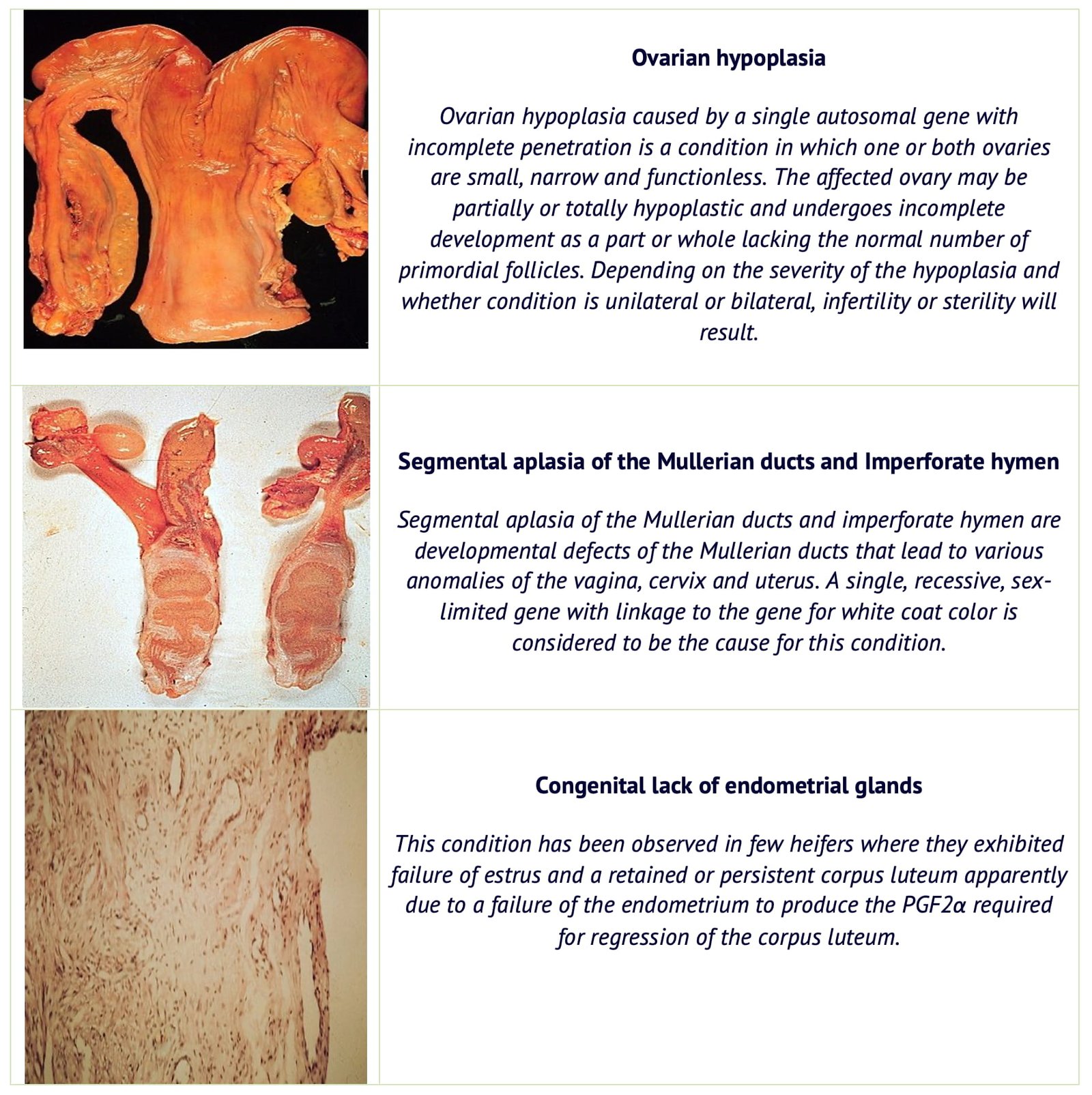 Ovarian Hypoplasia, Segmental Aplasia of the Mullerian Ducts and Imperforate Hymen and Congenital Lack of Endometrial Glands