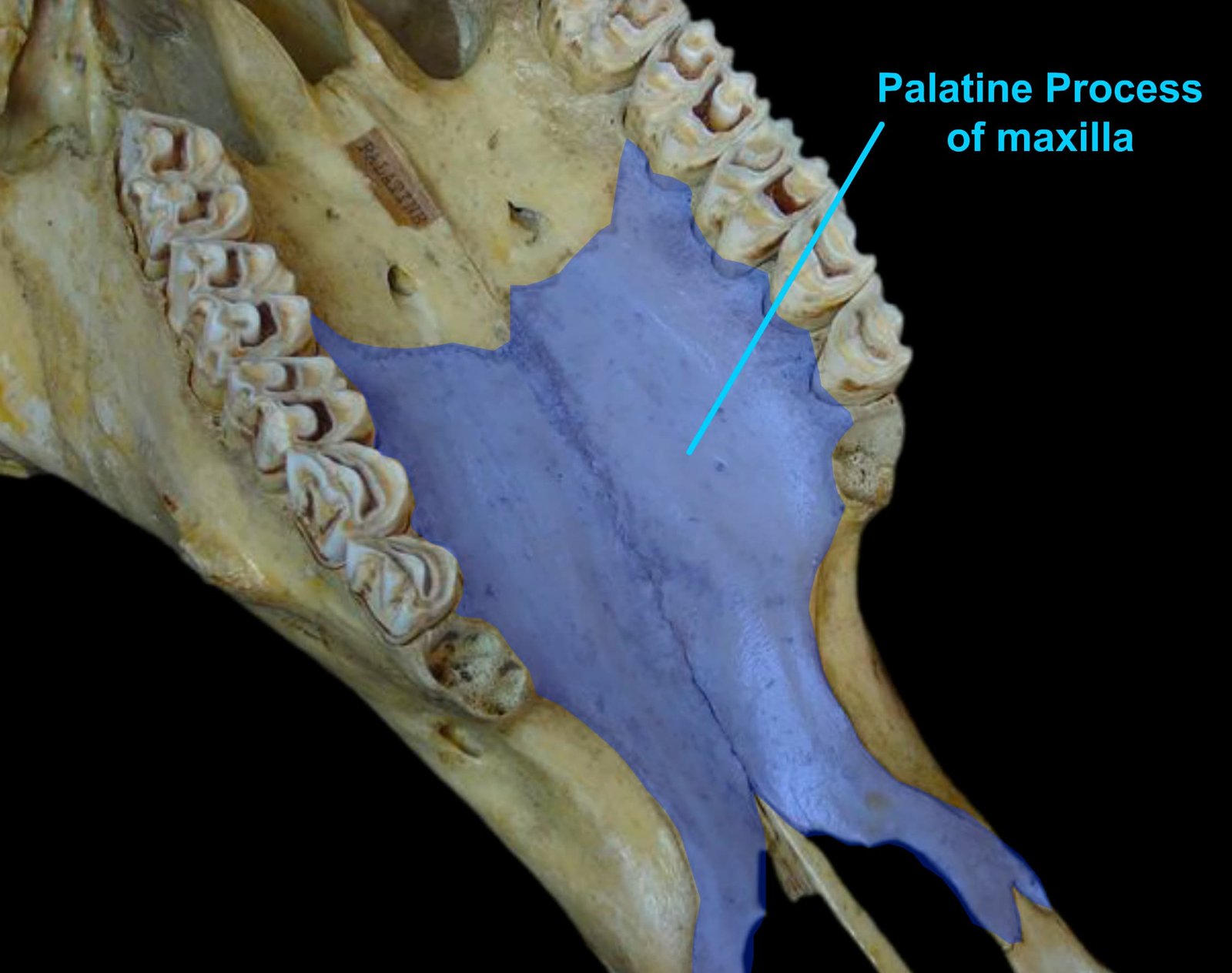 Palatine Process of the Maxilla Bone Forming the Hard Palate