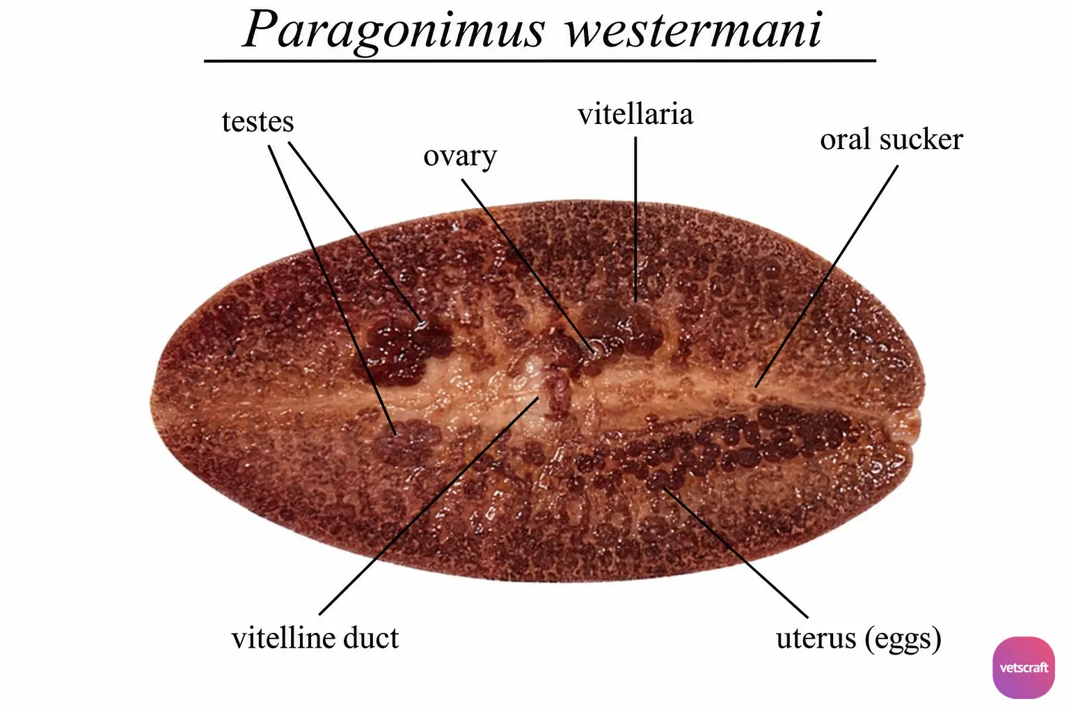 Paragonimus westermani (Oriental Lung Fluke)