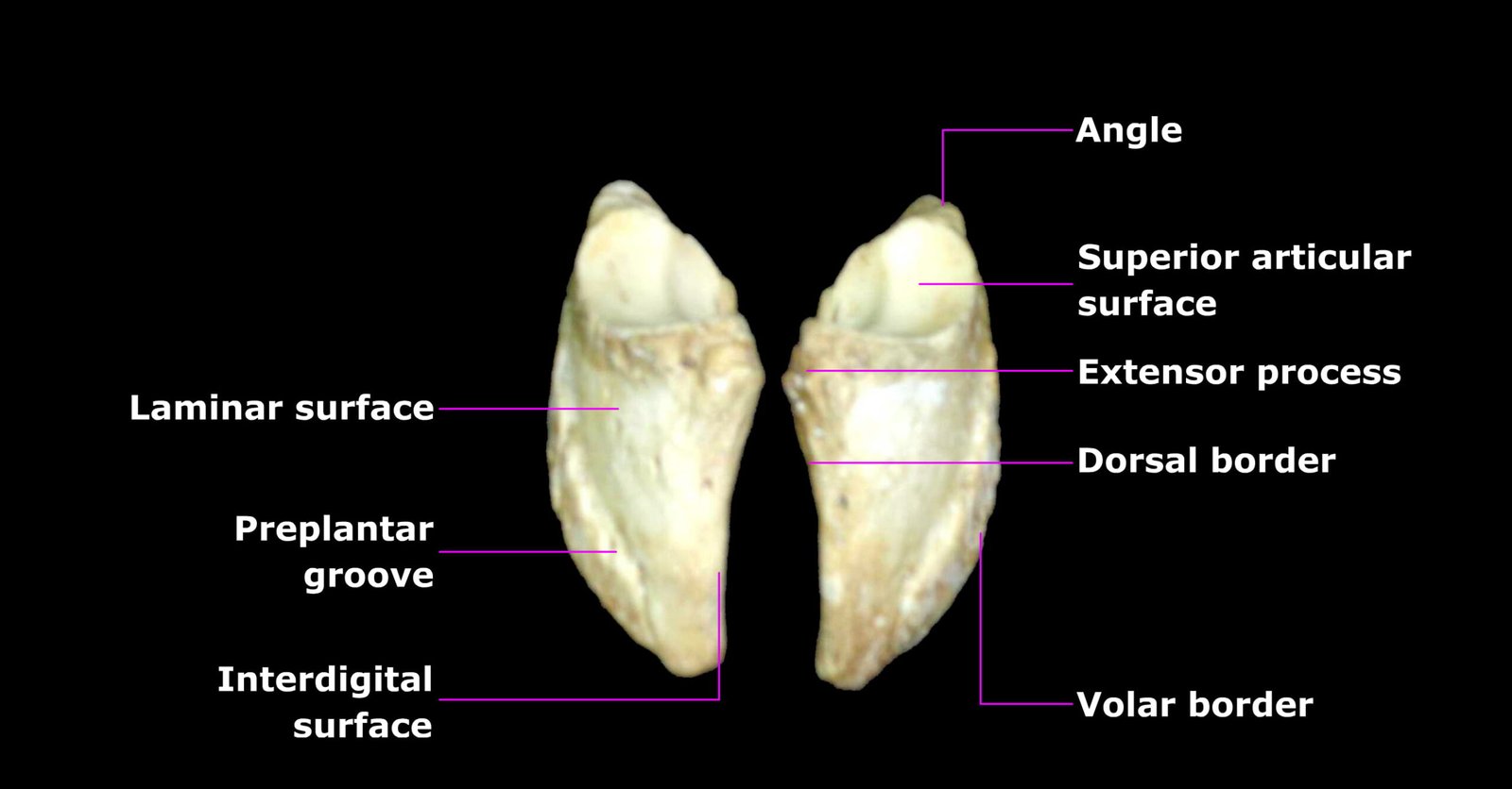Phalanges - Dorsal View