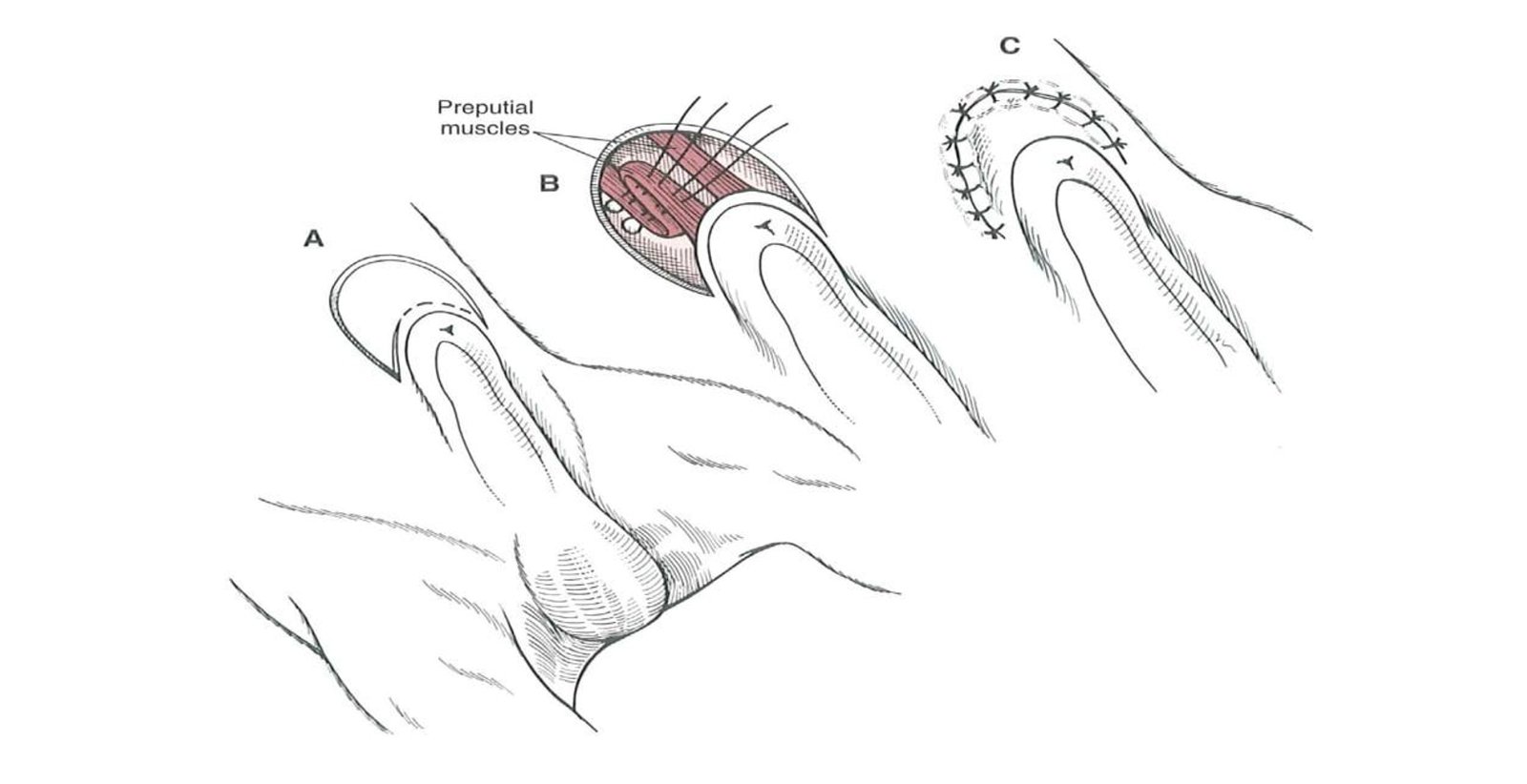 Preputial Lengthening in Dogs