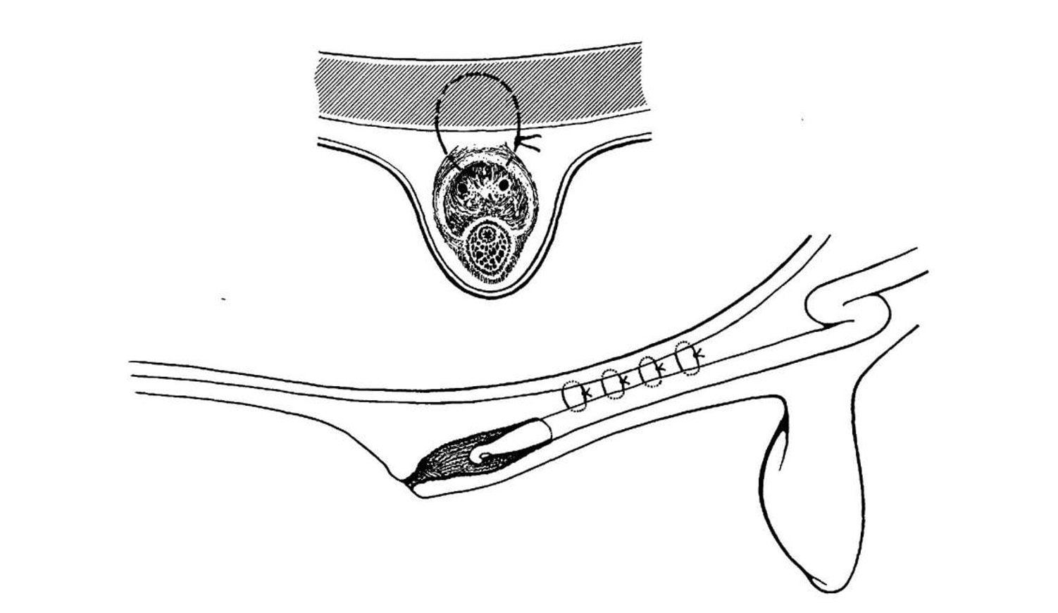 Schematic Diagram Representing the Fixation of Penis to the Linea Alba (Penopexy in Bulls)