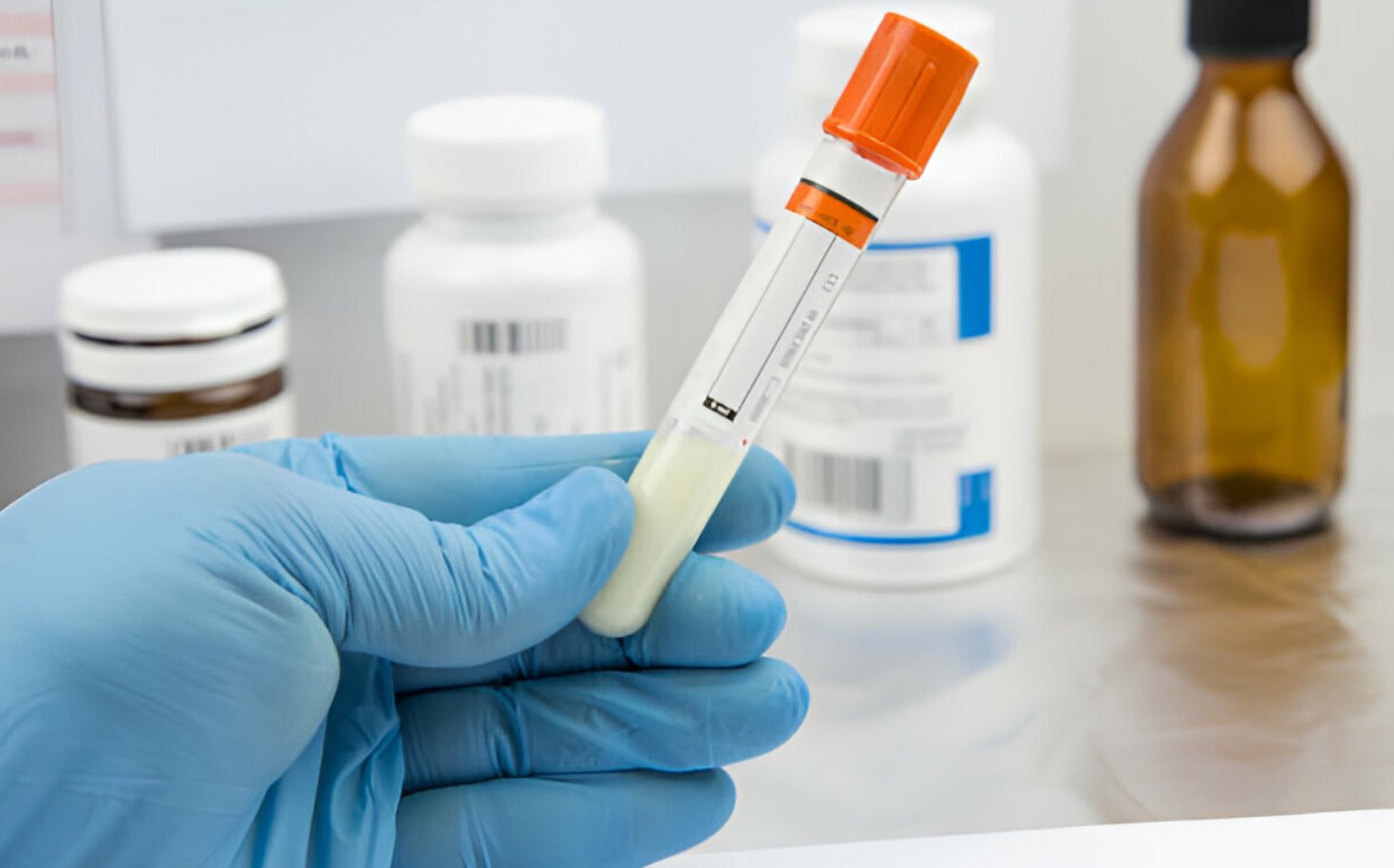 Semen Evaluation Techniques