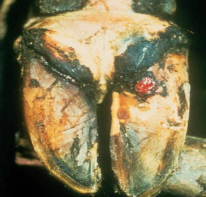 Sole Ulcers or pododermatitis septica circumscripta in a Cattle