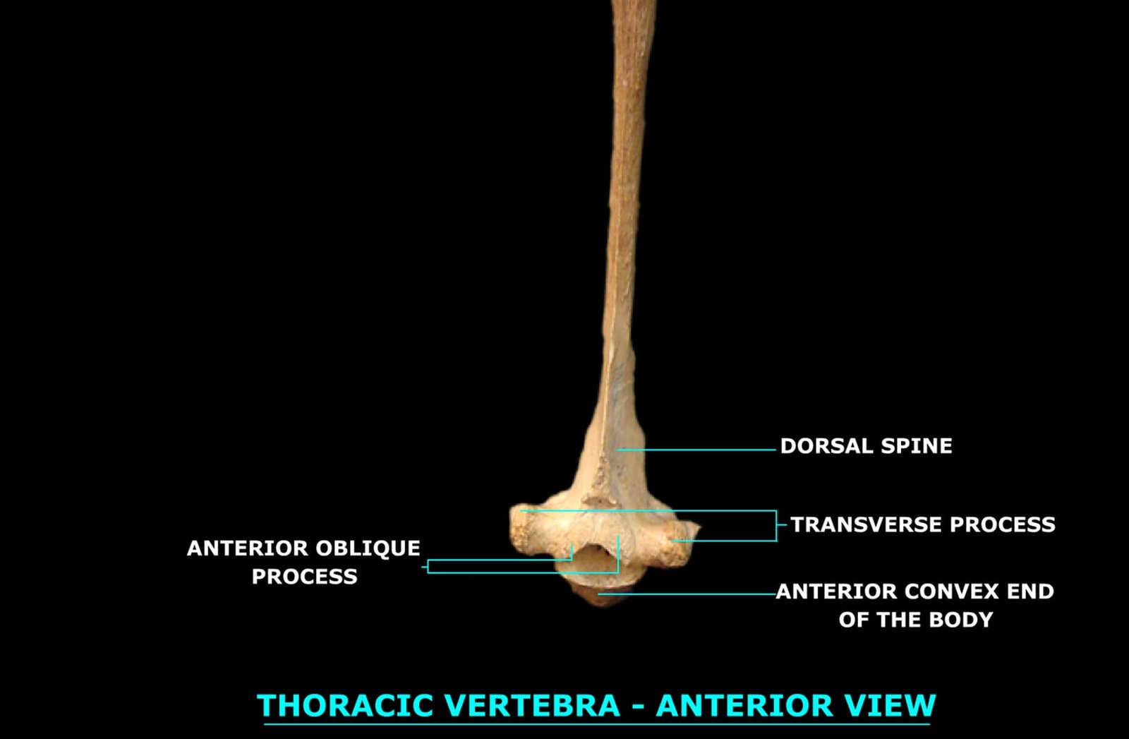 THORACIC VERTEBRA (ANTERIOR VIEW)