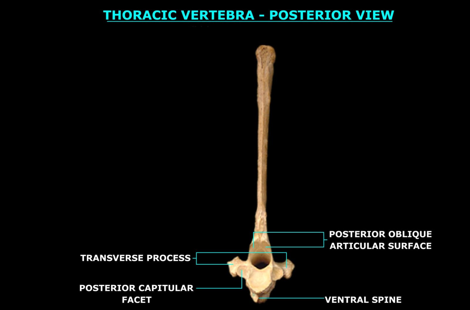THORACIC VERTEBRA (POSTERIOR VIEW)