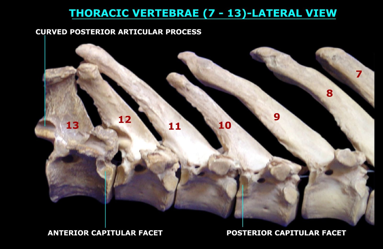 THORACIC VERTEBRAE (7th-13th) (LATERAL VIEW)