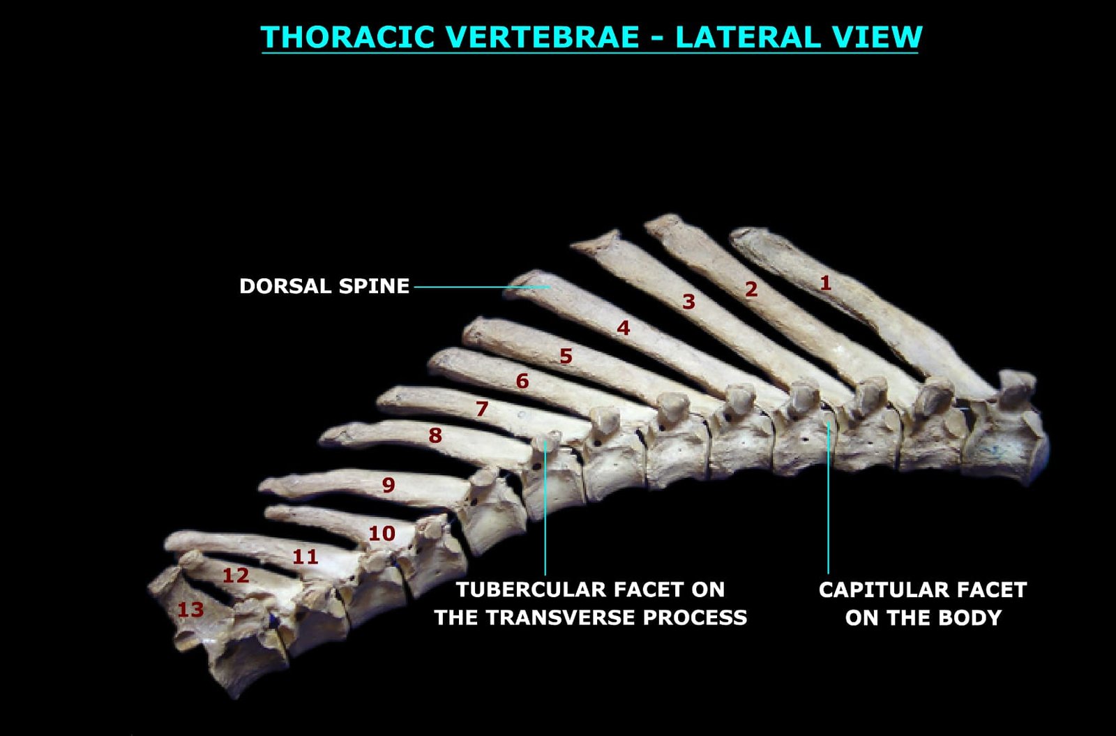 THORACIC VERTEBRAE (LATERAL VIEW) (2)