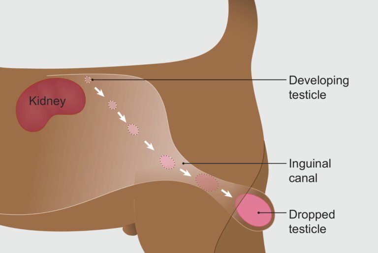 Cryptorchidism in Male Animals | Symptoms and Fertility Impact